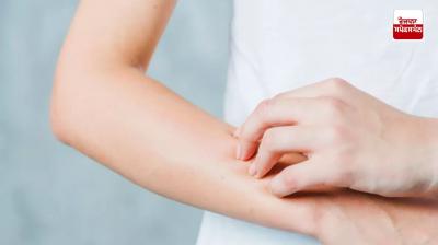 Follow these home remedies to protect your hands from dryness in winter