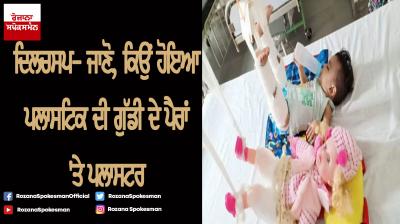 to fix 11 month olds fracture doctors first had to plaster her doll