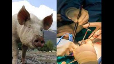   Pig Kidney Transplant 