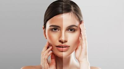  Home Remedies for Sun Tanned Skin