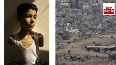 Photo of boy who lost both hands in Israeli attack selected for ‘World Press Photo of the Year’