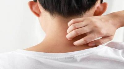 If you have rashes on your skin then follow these home remedies