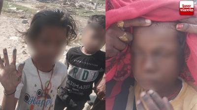 ਝੁਲਸੇ ਹੋਏ ਬੱਚੇ 