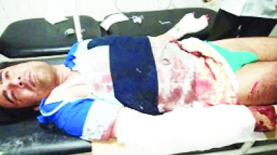 Pulkit In Serious Condition Injured