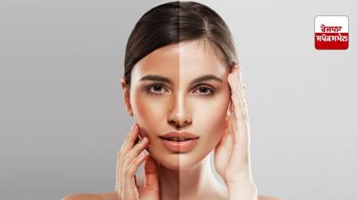 Home remedies for sun-tanned skin