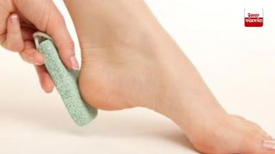 Here's how to take care of your heels in winter