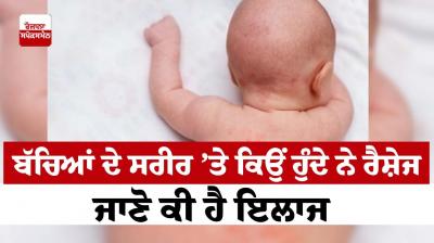 What is the treatment for rashes on the body of children?