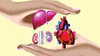 Representational Image