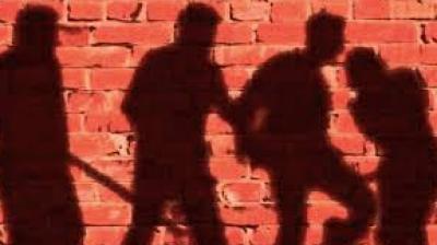 Representative Image.