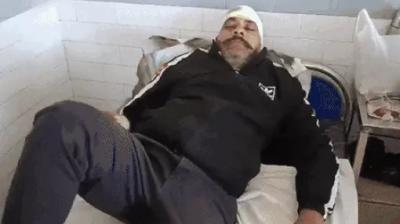 Injured Sunder Kumar