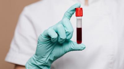 50 years old mystery related to blood group solved, scientists discovered rare blood group