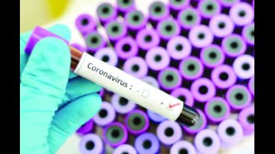 ਪੰਚਕੂਲਾ ਜ਼ਿਲ੍ਹੇ 'ਚ 793 ਸ਼ੱਕੀ ਕੋਰੋਨਾ ਵਿਅਕਤੀਆਂ ਨੂੰ ਨਿਗਰਾਨੀ ਵਿਚ ਰਖਿਆ