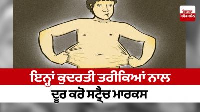 Get rid of stretch marks with these natural methods