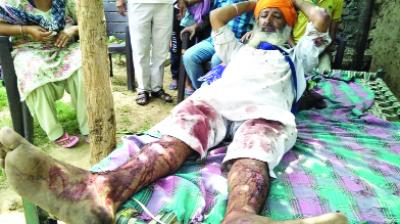 Military Man with Broken Legs