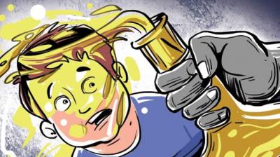 Acid attack (Representative Image)