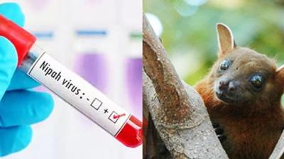 Nipah Virus