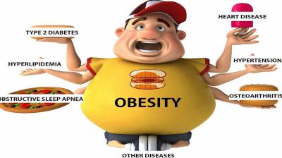 Obesity