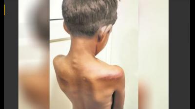 akali leader child beating