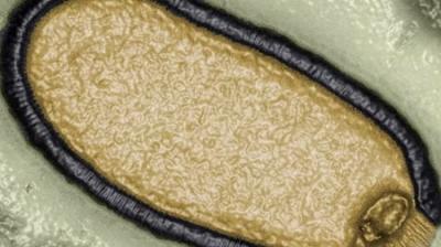 'Zombie' Virus Which Spent 48,500 Years Frozen In Arctic Could Spark Deadly Pandemic