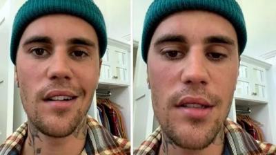 Justin Bieber reveals facial paralysis after shows cancelled