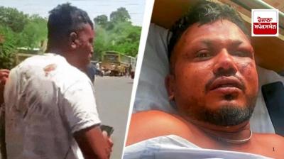 Ahmedabad plane crash: Did not jump from the plane, Vishwas Kumar tells how he saved his life