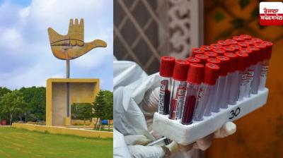 Dope test mandatory for bus drivers and conductors of private schools, DEO will take report