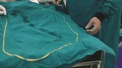 Kaithal alive insect of 6.3 feet long removed from the patients intestine