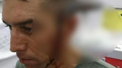 Man with knife buried 