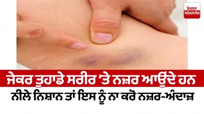 If you see blue marks on your body, do not ignore it