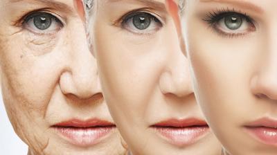 Skin Aging