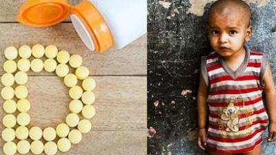 Vitamin D can improve the Malnutrition