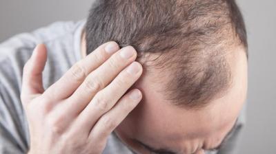 Take Special Care of The Hair