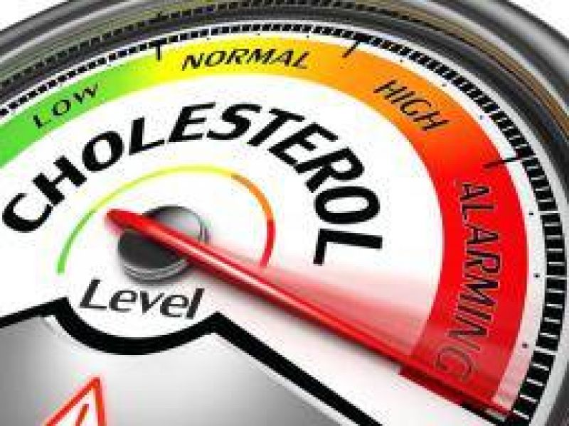 Cholesterol