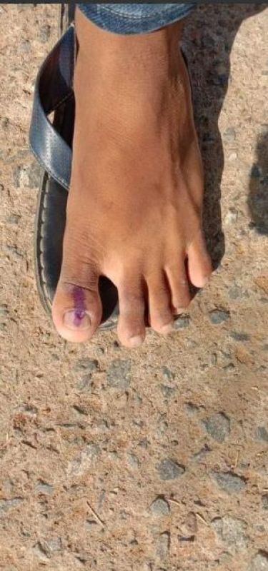 Zakir Pasha vote using his foot