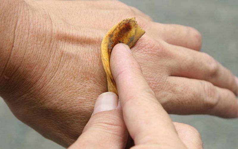 Apply banana peel on Skin Wart