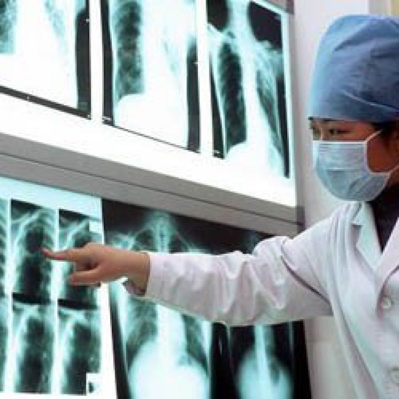 good news for TB patients new technology 