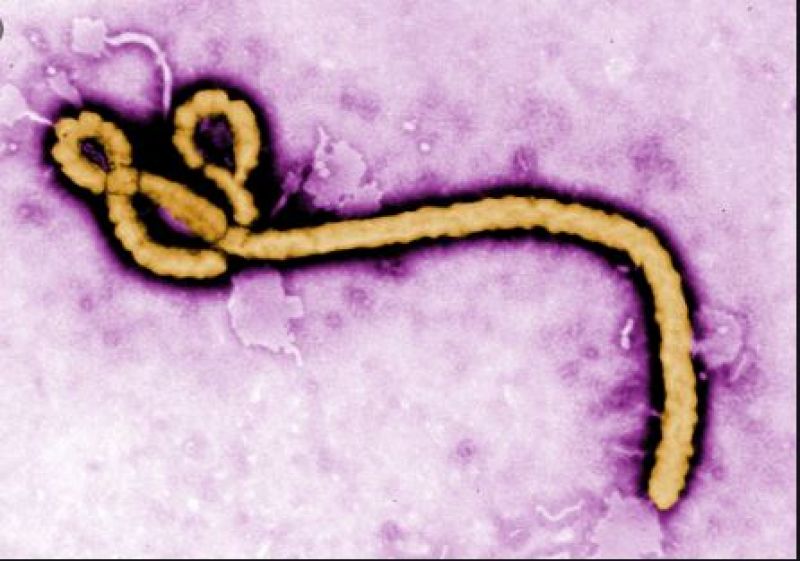 Ebola Virus