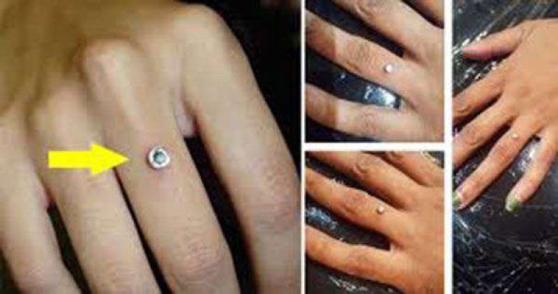 Ring Piercing