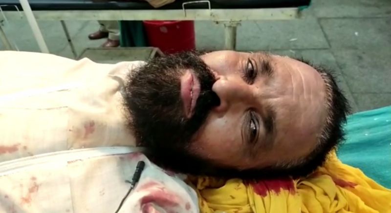 Fighting between two brothers over watering the field