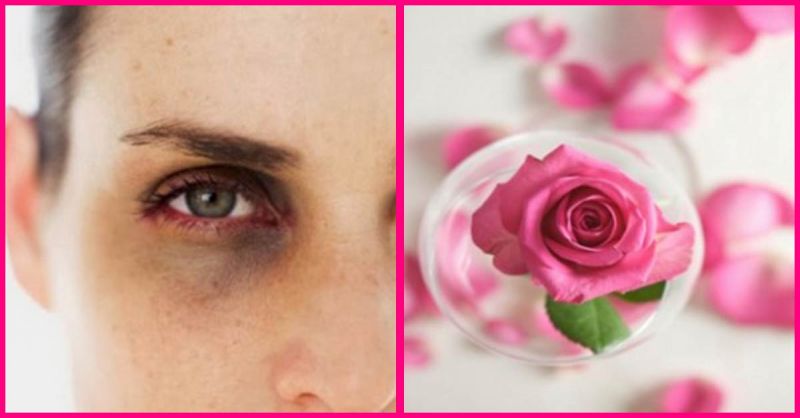 Rose water on eyes