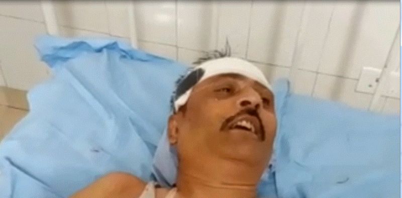 Brutally beaten Father