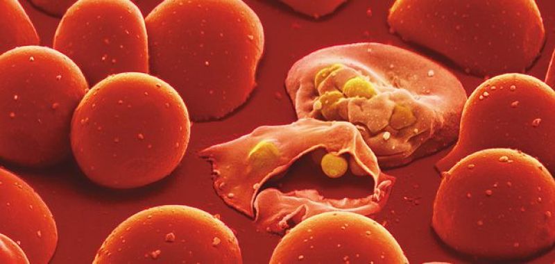 Malaria Malaria