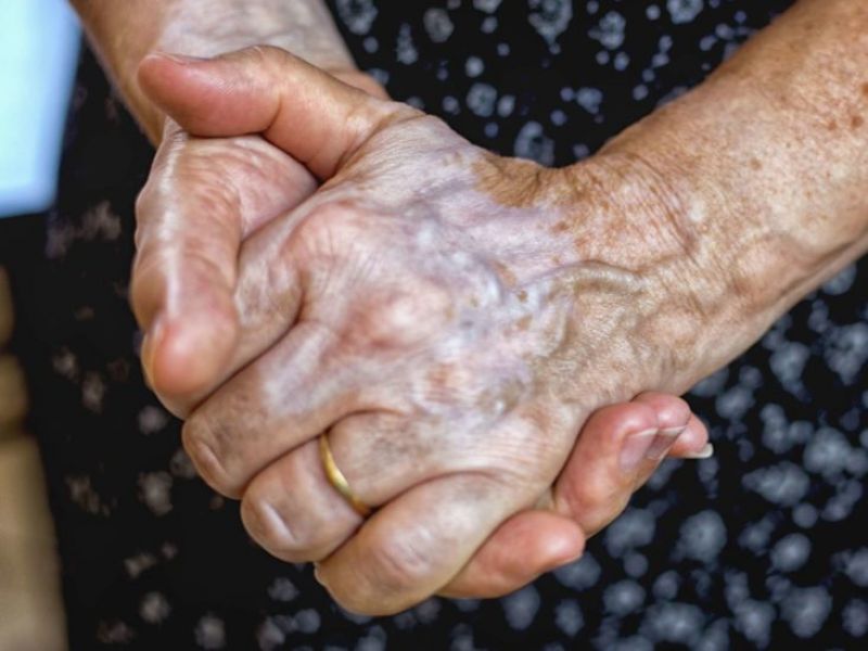 Visible veins on the body can cause major problems Visible veins on the body can cause major problems