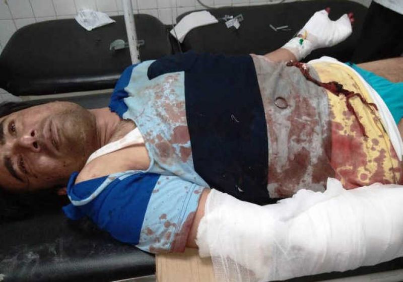 Deadly attack on Brother in Law