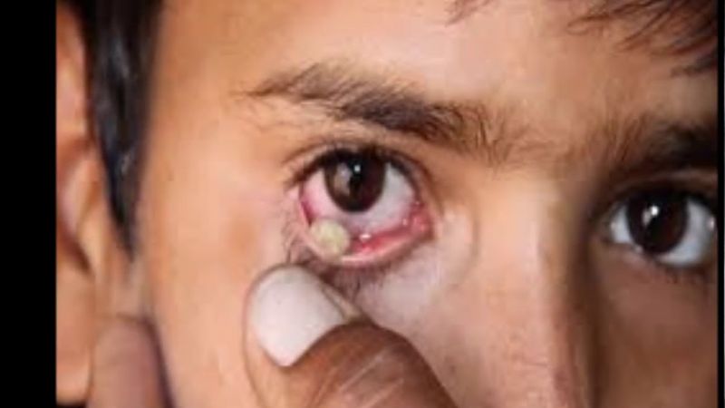 strange medical case