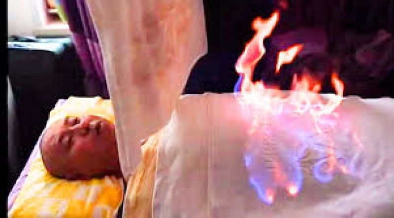 Fire therapy in china