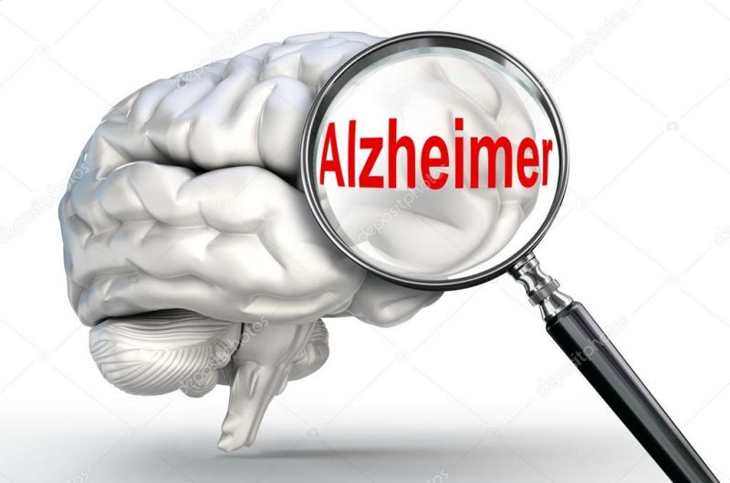 Alzheimer 