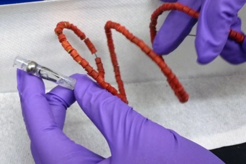 good news for TB patients new technology 