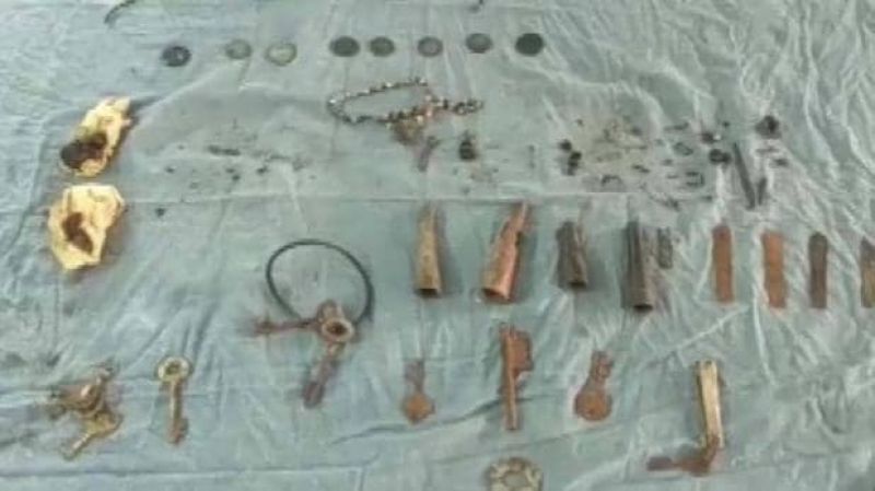 Coins and jewelry Removed From Woman Stomach In Bengal 