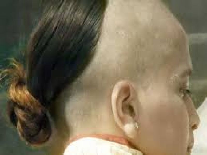 WWomans head sewn mans body truth of organ donation centre